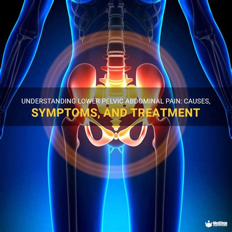 Understanding Lower Pelvic Abdominal Pain Causes Symptoms And Treatment Medshun