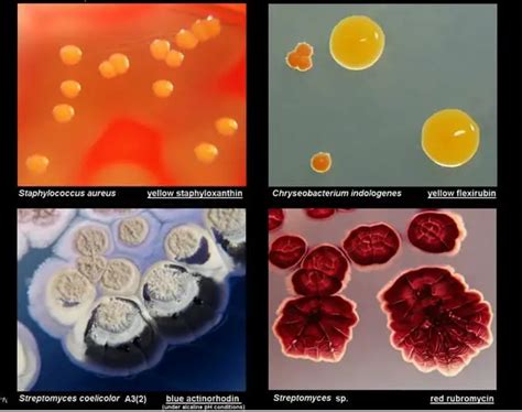 Colony Morphology Of Various Bacteria