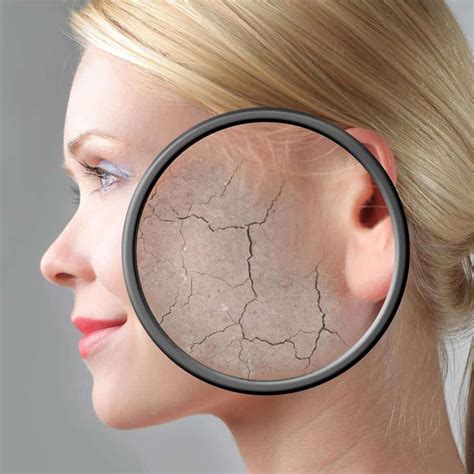 Dry Skin Explained Causes Prevention And Treatment Dermeze
