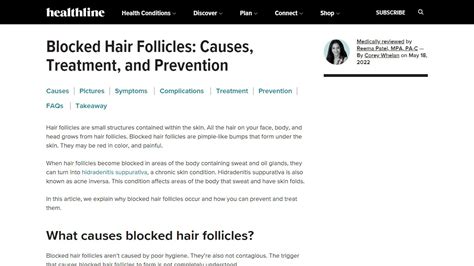 White Spots On Hair Follicles Beauty Tips
