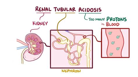 Renal Tubular Acidosis Video Anatomy Definition Osmosis