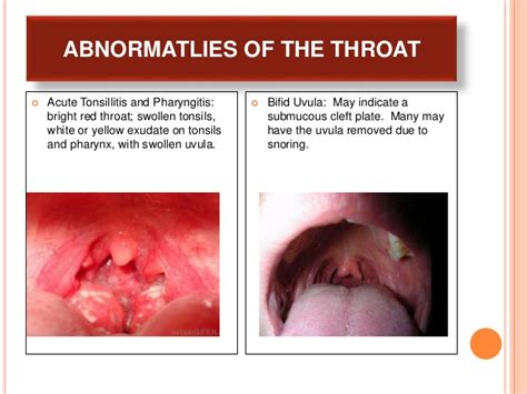 Nose Mouth And Throat Physical Assessment Power Point