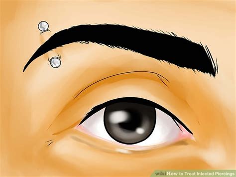 How To Treat Infected Piercings 14 Steps With Pictures