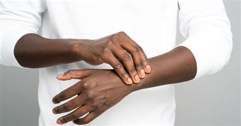 Artrite reumatóide o que é sintomas e como tratar