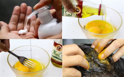 Five Effective Home Remedies For Hair Loss Necolebitchie