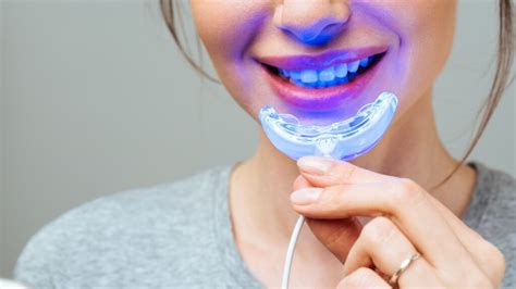 Best Led Teeth Whitening Kit Modern Dental Hygiene