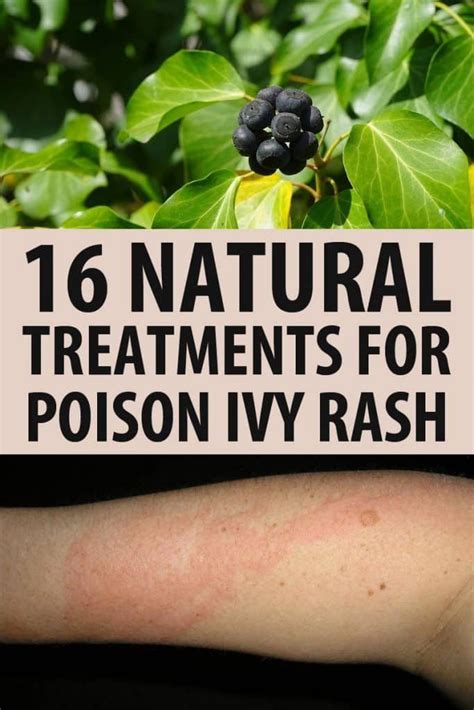 Poison Ivy Treatment Home Remedies Natural Remedies Natural