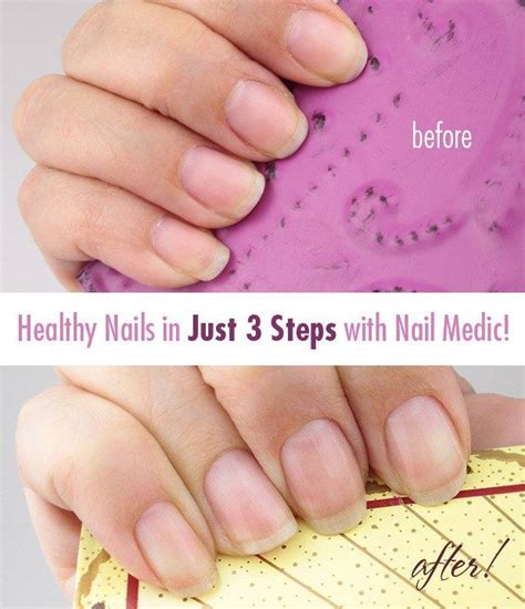 How To Get Healthy Nails In Just 3 Steps Healthy Nails Nails Get