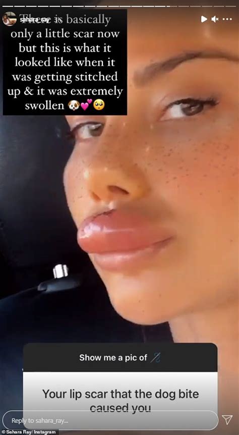The 2020s started off pretty rough, you could even say horribly. What happened to her lips? Sahara Ray shows off her VERY ...