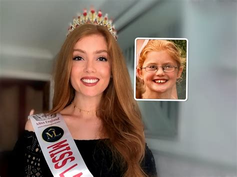 Redhead Bullied As Kid Gets Last Laugh By Becoming Beauty Pageant Finalist Talker