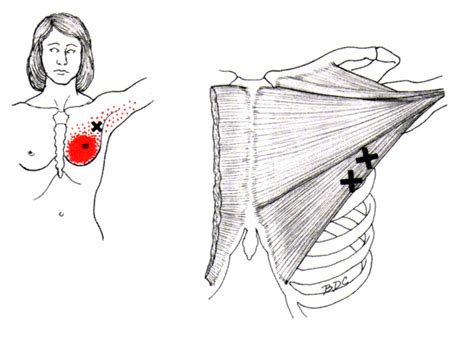 Pectoralis Major On Women Draw Accurate Bones And Muscle Bones And