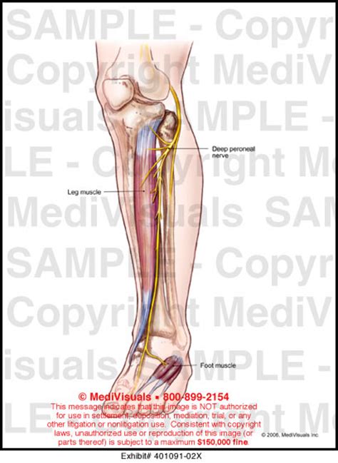 Medivisuals Peroneal Nerve Medical Illustration