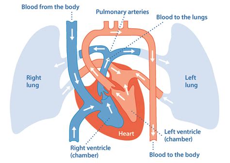 What Is Pulmonary Hypertension Asthma Lung Uk