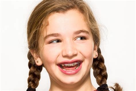 Early Orthodontic Treatment For Some Common Problems May Not Save Time