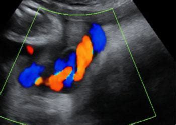 Ejemplos y fotografías de ecografías del embarazo