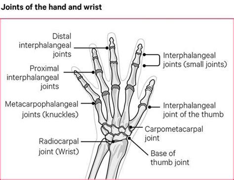 Hand And Wrist Pain Causes Exercises Treatments
