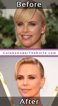 Charlize Theron Plastic Surgery Photos Before After Celebsundertheknife Celebs Celebrity