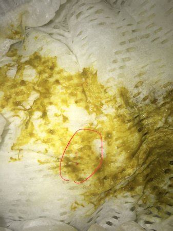 The first time a baby has cows' milk, it's very likely to be in formula. Does this look like dairy allergy poop? - BabyCenter