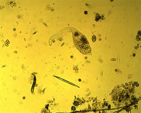 Freshwater Microorganism Images Save The Water