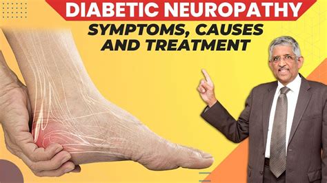 What Causes Diabetic Neuropathy Peripheral Neuropathy Dr V Mohan