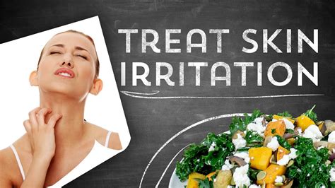 How To Treat Skin Irritation Naturally Skinside Out Youtube