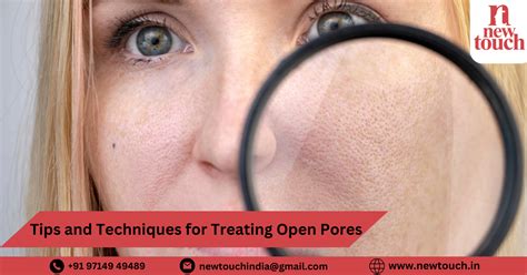 Tips And Techniques For Open Pores Treatment