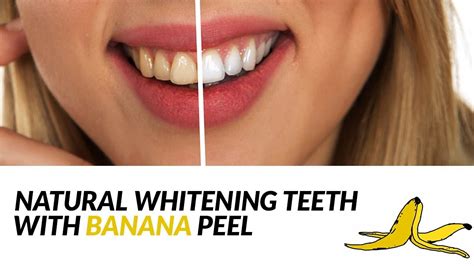 Whiten Your Teeth With Banana Peel In Just 2 Days Youtube