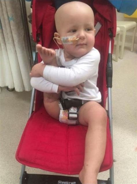 Babys Leg Reattached Backwards After Being Amputated Through Cancer