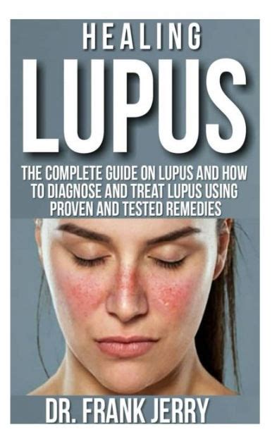 Healing Lupus The Complete Guide On Lupus And How To Diagnose And