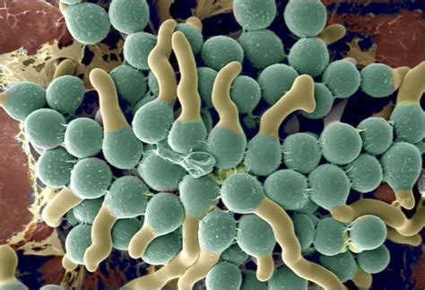 Chain of conidia of alternaria. Spores, fungal; Conidia; Fungal Spores