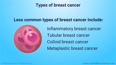 Slide Show Understanding Breast Cancer