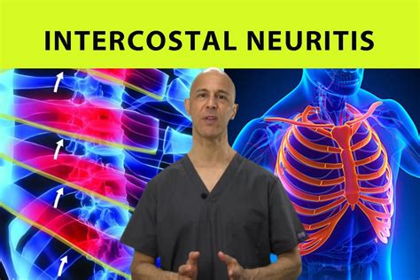 Rib cage pain on both sides may be sharp, dull, or achy and felt at or below the chest or above the navel on either side. Intercostal Neuritis Relief (Mid Back Pain, Rib & Chest ...