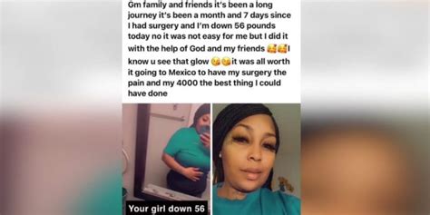 botched bbl black woman undergoes plastic surgery in dominican republic that turns deadly all