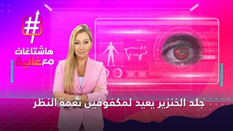 ‫dw عربية لماذا يحرم أكل لحم الخنزير في أكثر من ديانة facebook‬