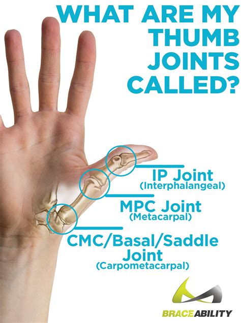 Pin On Thumb Pain Relief Treatments And Splints For Basal Joint