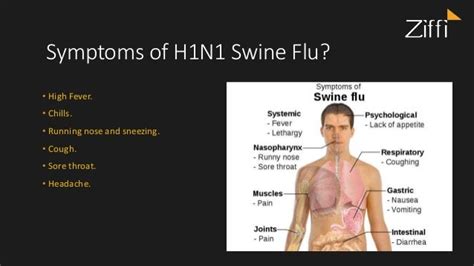 H1n1 Swine Flu Symptoms Causes Prevention Tests And Vaccination