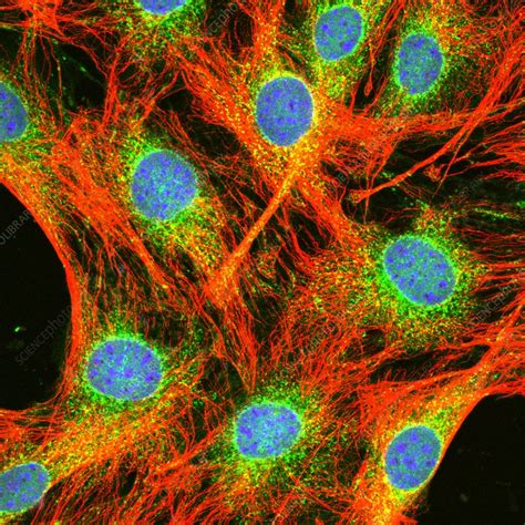 Fibroblast Cells Stock Image P7800083 Science Photo Library