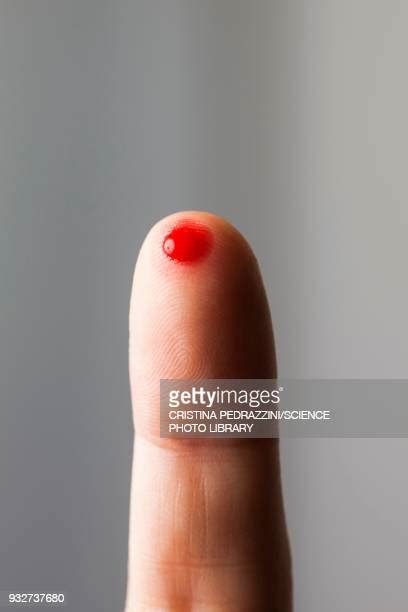 Bloody Finger Photos And Premium High Res Pictures Getty Images