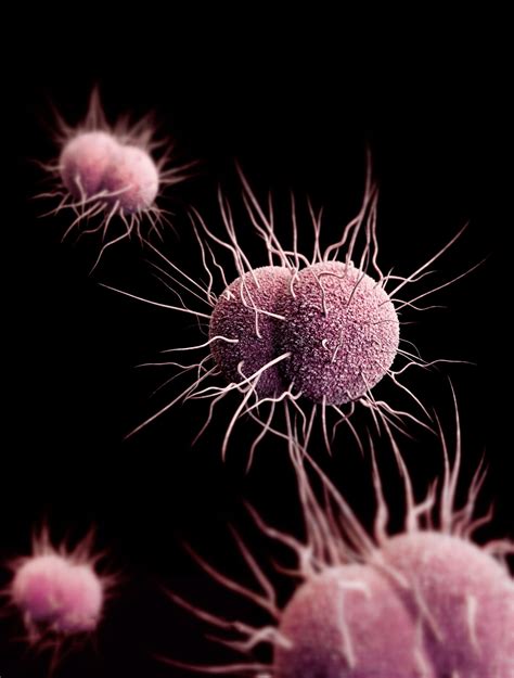 gonorrhea may soon be untreatable britain s chief medical officer warns the washington post