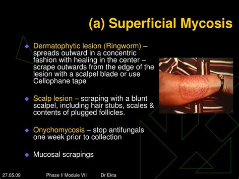 Ppt Laboratory Diagnosis Of Fungal Infections Powerpoint Presentation
