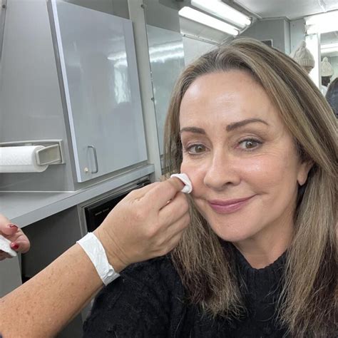 Patricia Heaton Plastic Surgery Photos Before After Surgery