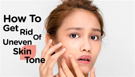 How To Get Rid Of Uneven Skin Tone Shoppelk