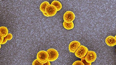 Groundbreaking Antibiotic Breaks Silence On Global Health Crisis Archyde
