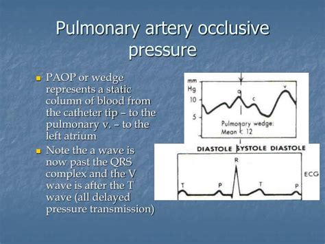 Ppt Right Heart Catheterization Basic Right Heart Pressure Tracings