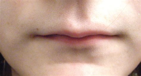what types of lips do you have know all the different types thin lips lips lip fillers