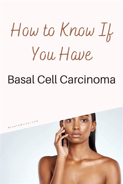 How To Know If You Have Basal Cell Carcinoma Blue To Bliss