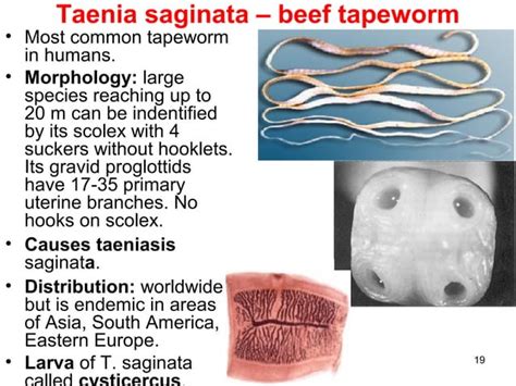 Class Cestoda Tapeworms