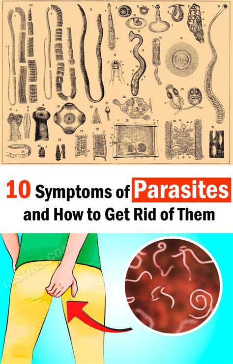 10 Symptoms Of Parasites And How To Get Rid Of Them Parasites Symptoms Parasite Recurring