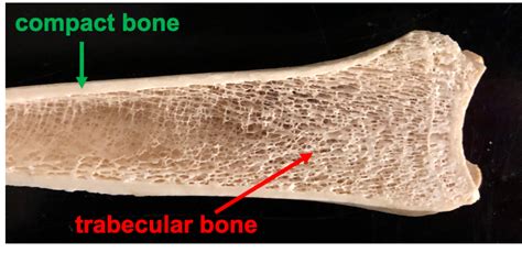 Spongy Bone Under Microscope