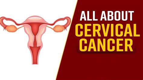Cervical Cancer Symptoms Causes Diagnosis And Treatment Max Lab